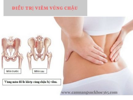 Điều trị viêm vùng chậu