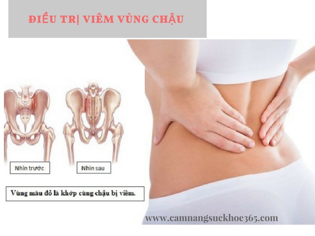Điều trị viêm vùng chậu