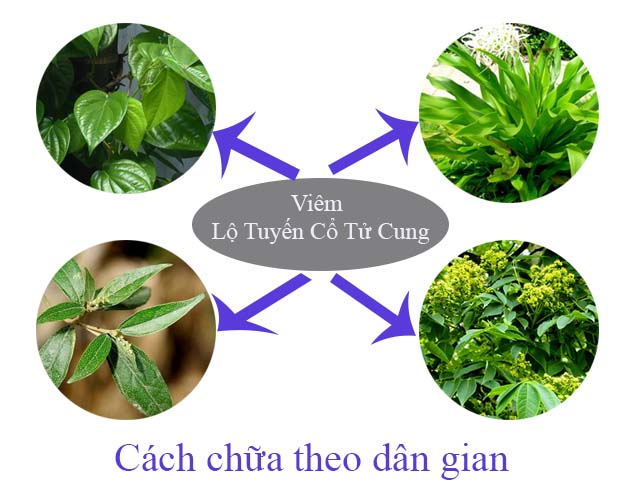 cách chữa bệnh viêm lộ tuyến 