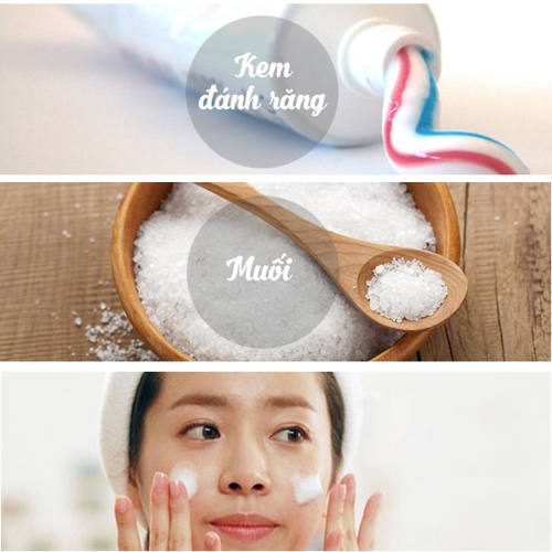 cách trị mụn bằng kem đánh răng