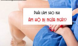 Âm hộ bị ngứa ngáy phải làm sao?