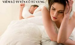 Dấu hiệu viêm lộ tuyến cổ tử cung