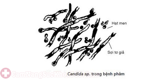 soi tươi dịch âm đạo