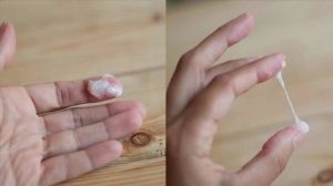 Dấu hiệu bệnh huyết trắng