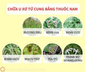 cách điều trị u xơ cổ tử cung