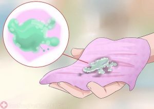 Khí hư màu xanh vón cục là dấu hiệu cho thấy vùng kín