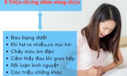 Triệu chứng viêm vùng chậu