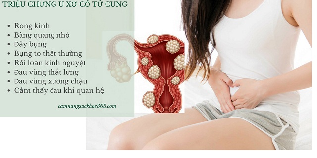 Triệu chứng u xơ cổ tử cung