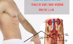 Triệu chứng viêm niệu đạo