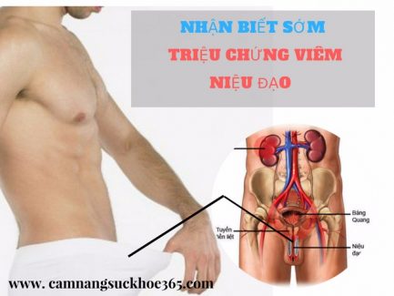 Triệu chứng viêm niệu đạo