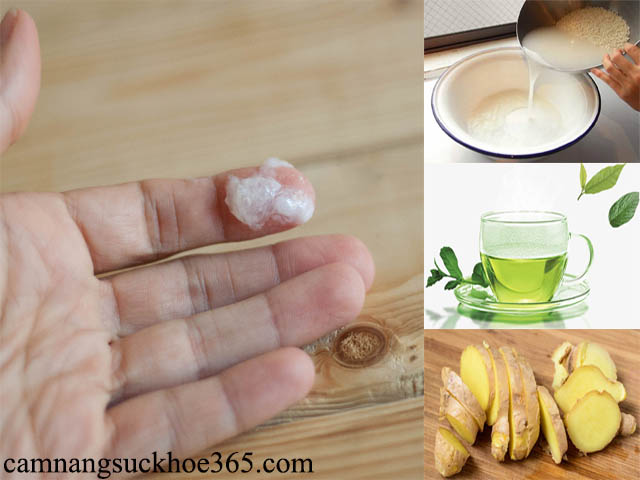 Cách chữa bệnh huyết trắng có mủ