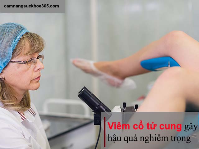 Điều trị sớm viêm cổ tử cung là cần thiết