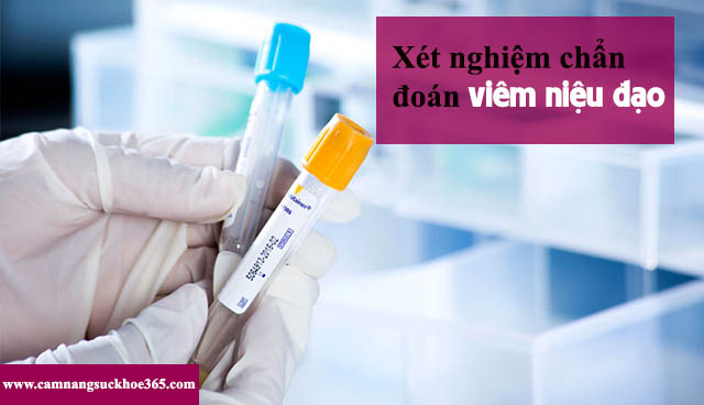 Chẩn đoán viêm niệu đạo