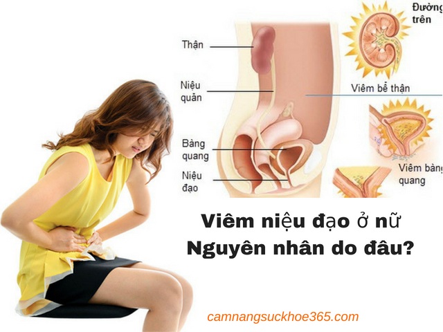 Nguyên nhân gây viêm niệu đạo ở nữ giới