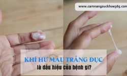 Khí hư màu trắng đục là bệnh gì?