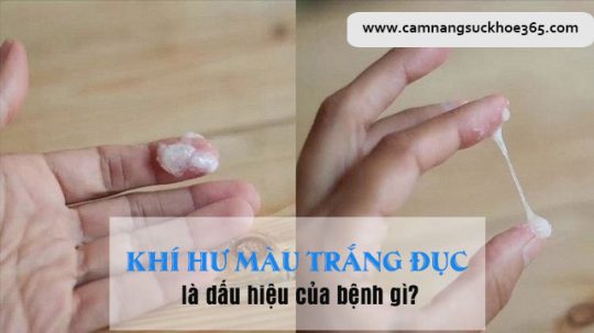 Khí hư màu trắng đục là bệnh gì?