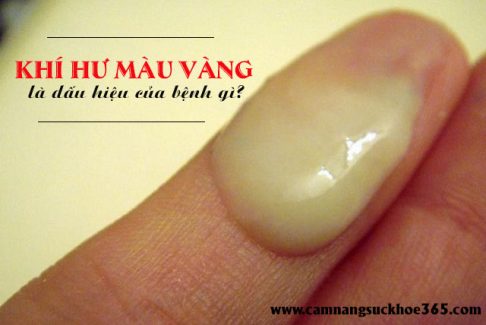Khí hư màu vàng là dấu hiệu của bệnh gì?