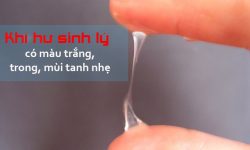 Khí hư như thế nào là bình thường?