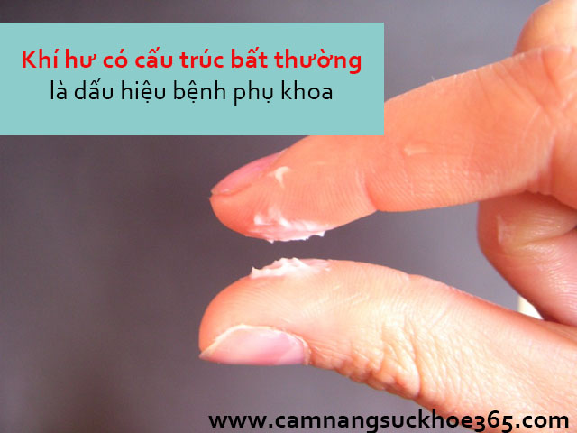 Khí hư bất thường có cấu trúc không ổn định