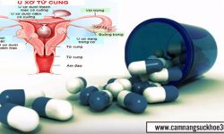 Bị u xơ tử cung nên uống thuốc gì cho nhanh khỏi?