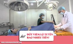 Chi phí đốt viêm lộ tuyến hết bao nhiêu tiền?