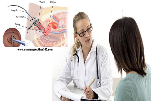 Chi phí đốt viêm lộ tuyến hết bao nhiêu tiền?