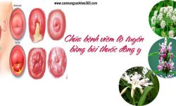 Chữa bệnh viêm lộ tuyến bằng bài thuốc đông y