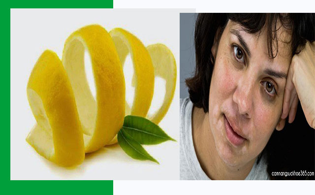 Chia sẻ cách chữa lang ben trên mặt nhanh khỏi