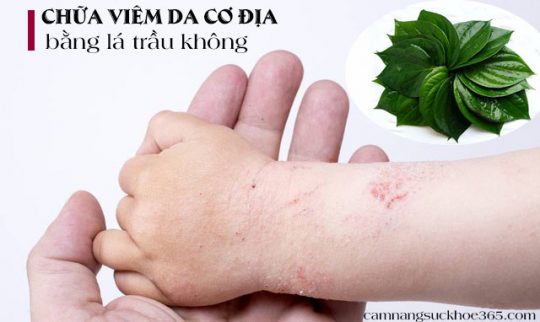 Chữa viêm da cơ địa bằng lá trầu không