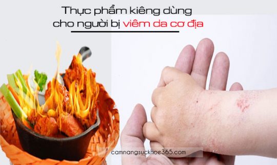 Thực phẩm kiêng dùng cho người bị viêm da cơ địa