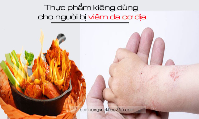 Thực phẩm kiêng dùng cho người bị viêm da cơ địa
