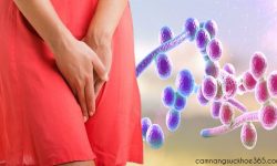 Ngứa âm đạo do nấm candida và những biện pháp khắc phục