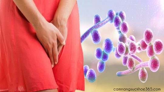 Ngứa âm đạo do nấm candida và những biện pháp khắc phục
