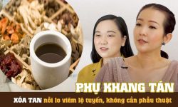 Phụ Khang Tán chữa viêm lộ tuyến