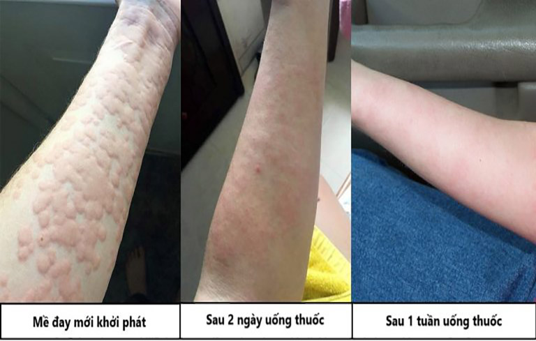 Trước và sau khi điều trị bằng thuốc của Trung tâm