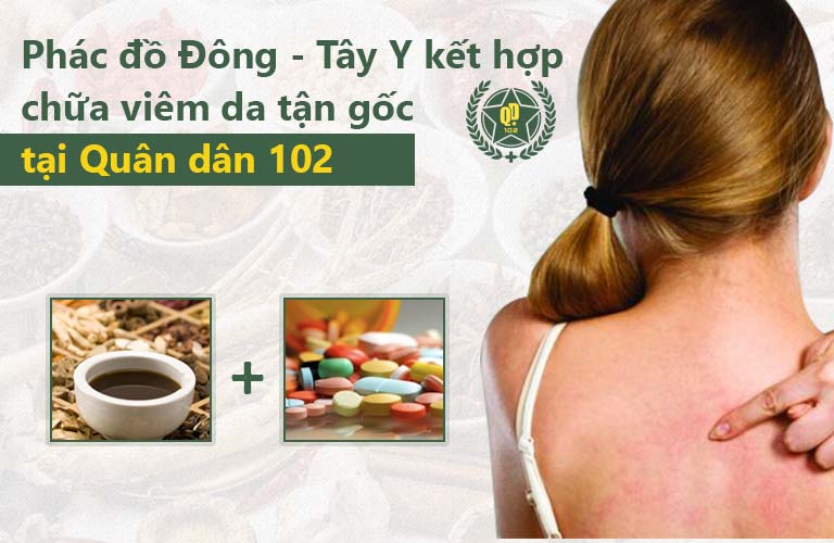 Chữa viêm da Quân dân 102 kết hợp cả Đông Tây y
