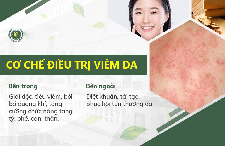Cơ chế điều trị viêm da tại Quân dân 102