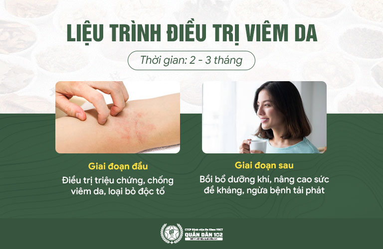 Liệu trình điều trị bệnh viêm da 