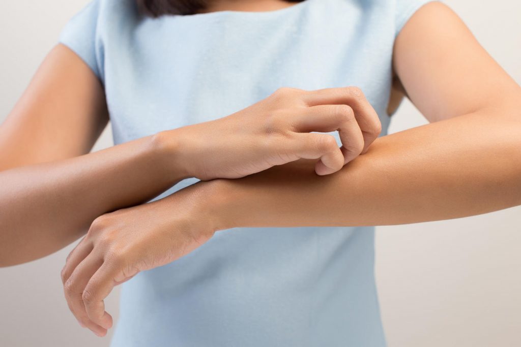Viêm da là bệnh lý ám ảnh với nhiều người