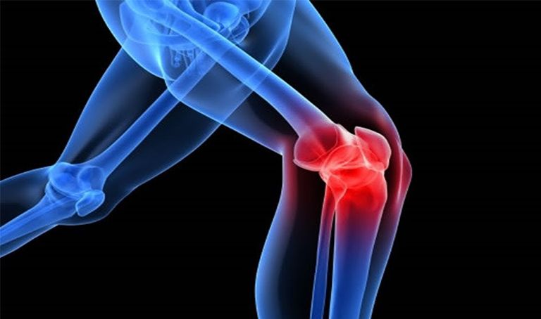 Người bị bệnh thoái hóa khớp gối có nên đi bộ, chạy bộ không?