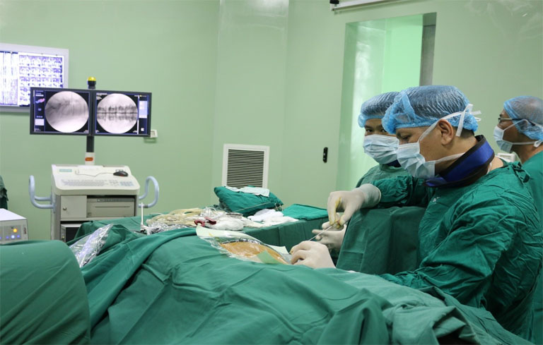 Mổ hở thoát vị đĩa đệm