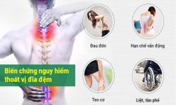 Thoát vị đĩa đệm gây nhiều biến chứng nguy hiểm