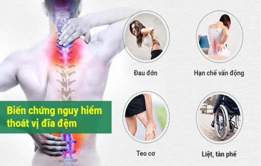 Thoát vị đĩa đệm gây nhiều biến chứng nguy hiểm