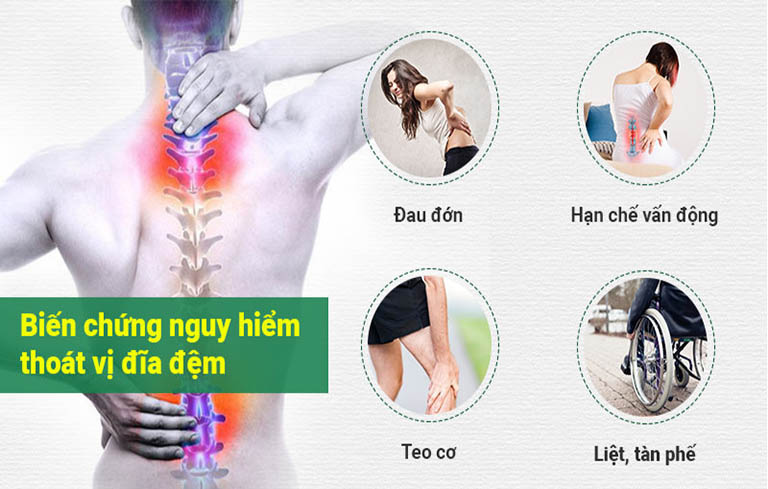 Thoát vị đĩa đệm gây nhiều biến chứng nguy hiểm